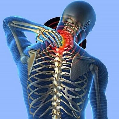 bol u vratu sa cervikalnom osteohondrozom