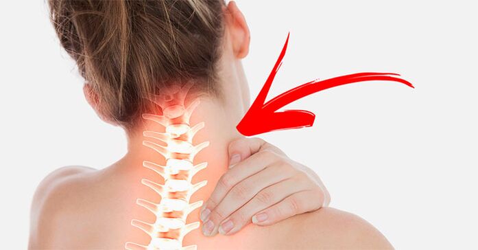 Bol za vrat Zašto i šta da radim